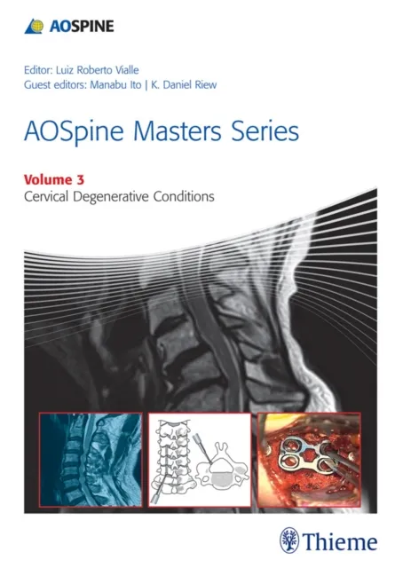 AOSpine Masters Series, Volume 3: Cervical Degenerative Conditions