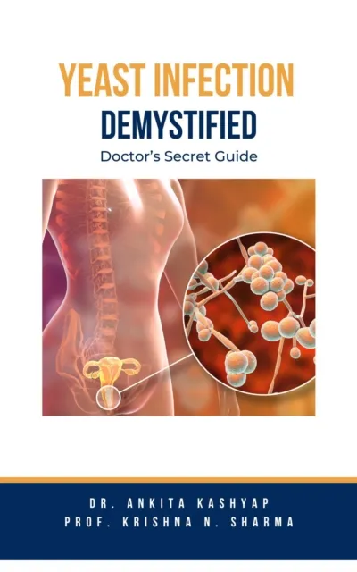 Yeast Infection: Demystified Doctor's Secret Guide