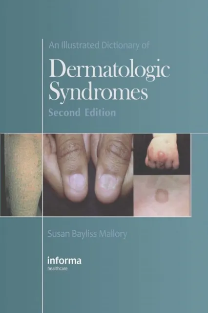 Illustrated Dictionary of Dermatologic Syndromes