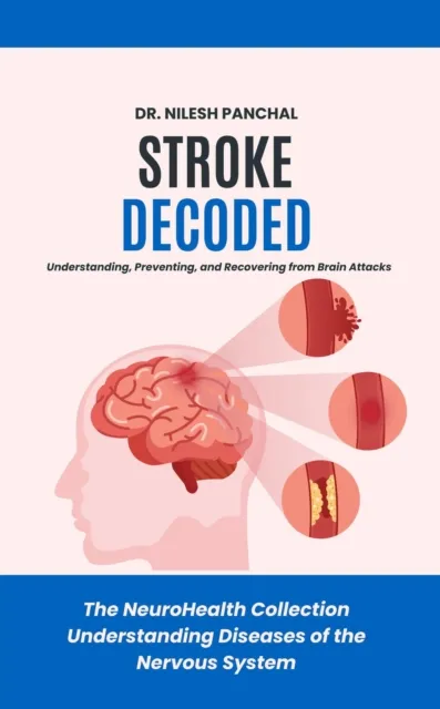 Stroke Decoded: Understanding, Preventing, and Recovering from Brain Attacks