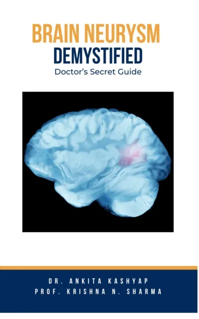 Brain Aneurysm Demystified: Doctor's Secret Guide