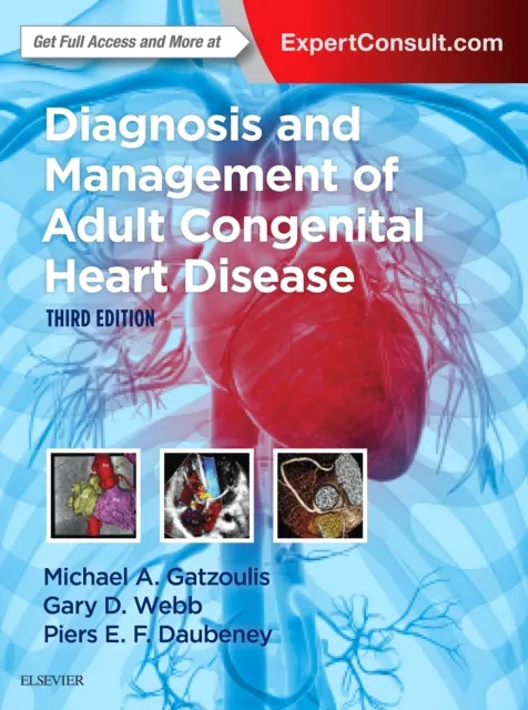 Diagnosis and Management of Adult Congenital Heart Disease E-Book