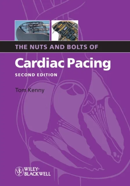 Nuts and Bolts of Cardiac Pacing