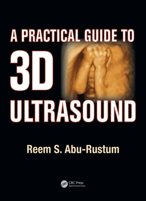 Practical Guide to 3D Ultrasound