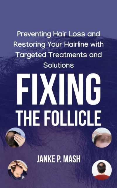 Fixing the Follicle: Preventing Hair Loss and Restoring Your Hairline with Targeted Treatments and Solutions
