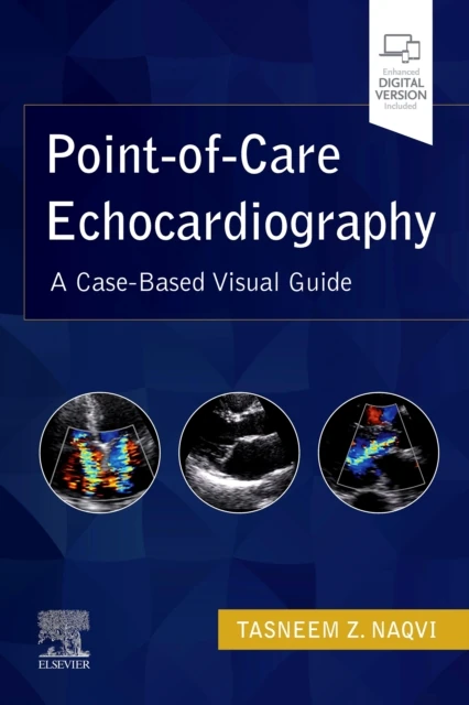Point-of-Care Echocardiography, E-Book
