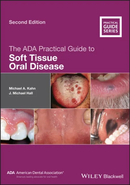 ADA Practical Guide to Soft Tissue Oral Disease