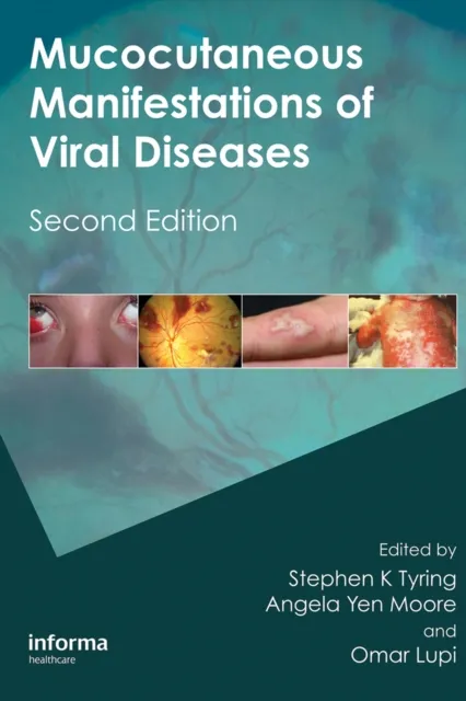 Mucocutaneous Manifestations of Viral Diseases