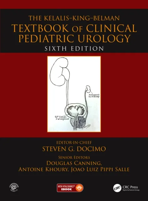 Kelalis--King--Belman Textbook of Clinical Pediatric Urology