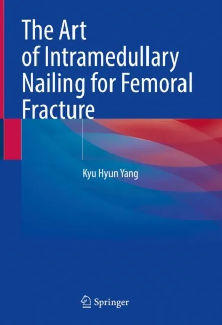 Art of Intramedullary Nailing for Femoral Fracture