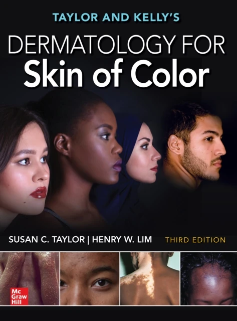 Taylor and Kelly's Dermatology for Skin of Color, Third Edition