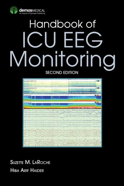 Handbook of ICU EEG Monitoring