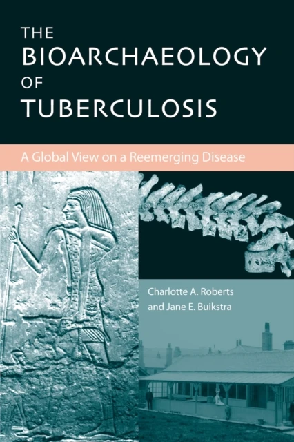 Bioarchaeology of Tuberculosis