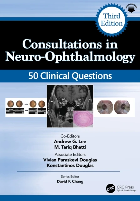 Consultations in Neuro-Ophthalmology