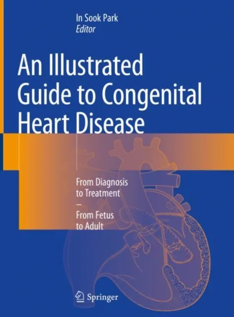 Illustrated Guide to Congenital Heart Disease