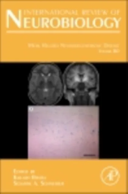 Metal Related Neurodegenerative Disease