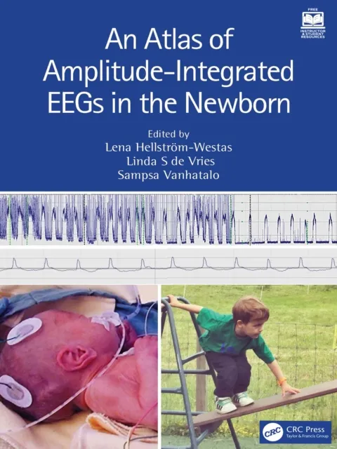 Atlas of Amplitude-Integrated EEGs in the Newborn