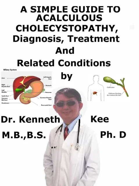 Simple Guide to Acalculous Cholecystopathy, Diagnosis, Treatment and Related Conditions