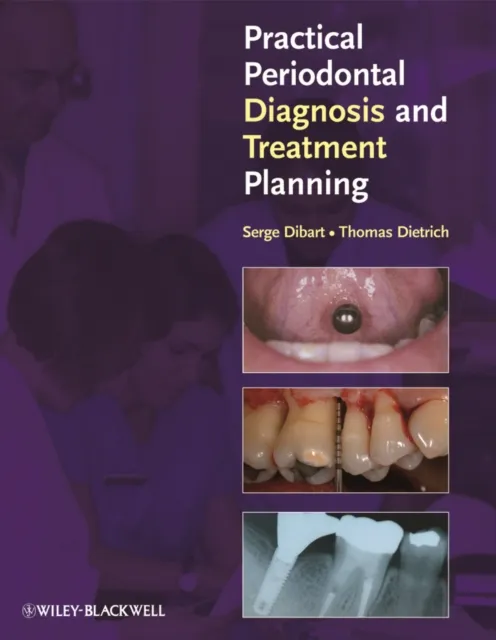Practical Periodontal Diagnosis and Treatment Planning