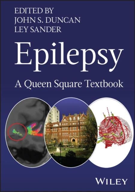 Epilepsy
