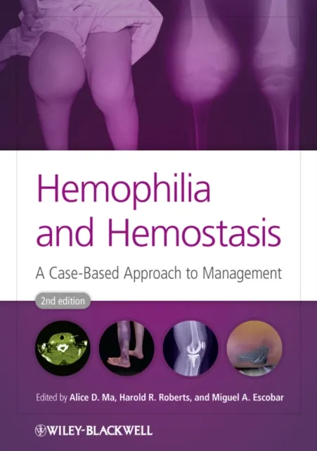 Hemophilia and Hemostasis