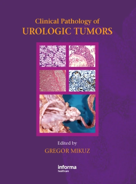 Clinical Pathology of Urological Tumours