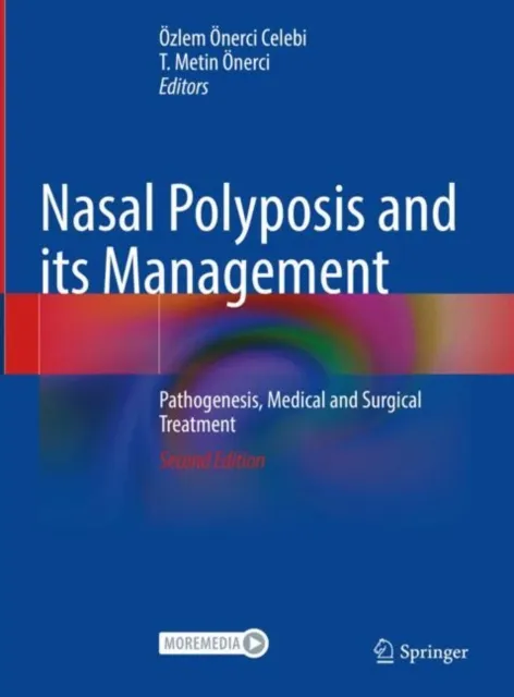 Nasal Polyposis and its Management