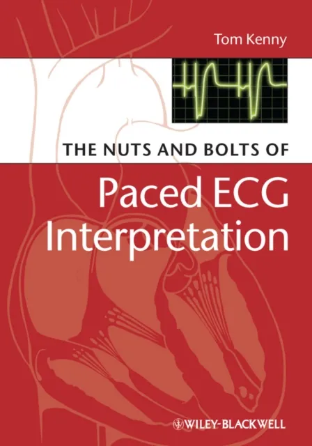Nuts and bolts of Paced ECG Interpretation