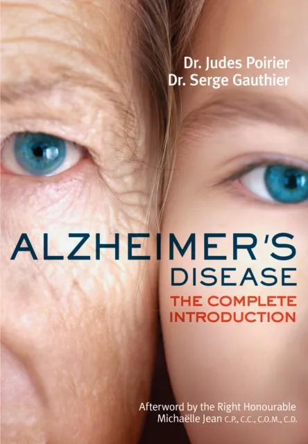 Alzheimer's Disease