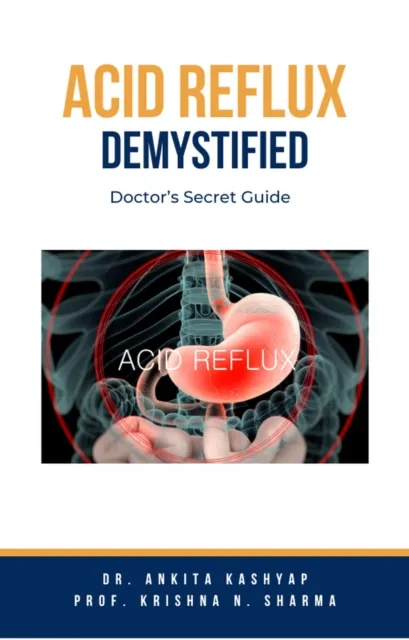 Acid Reflux Demystified: Doctor's Secret Guide