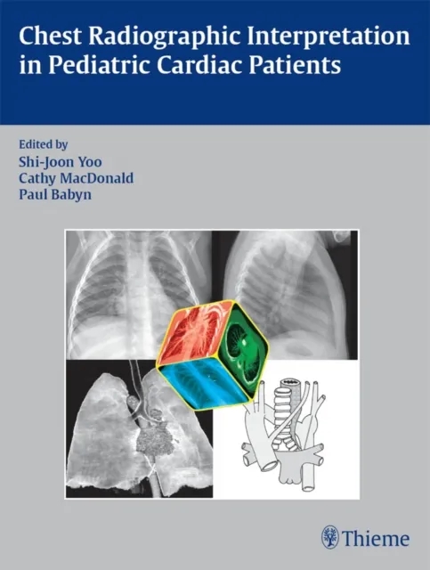 Chest Radiographic Interpretation in Pediatric Cardiac Patients
