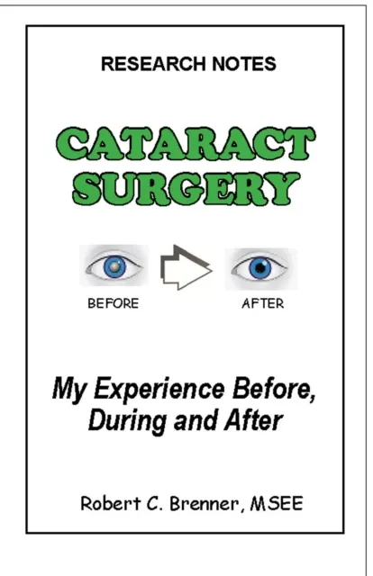 Cataract Surgery: My Experience Before, During and After