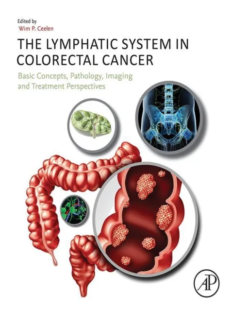 Lymphatic System in Colorectal Cancer