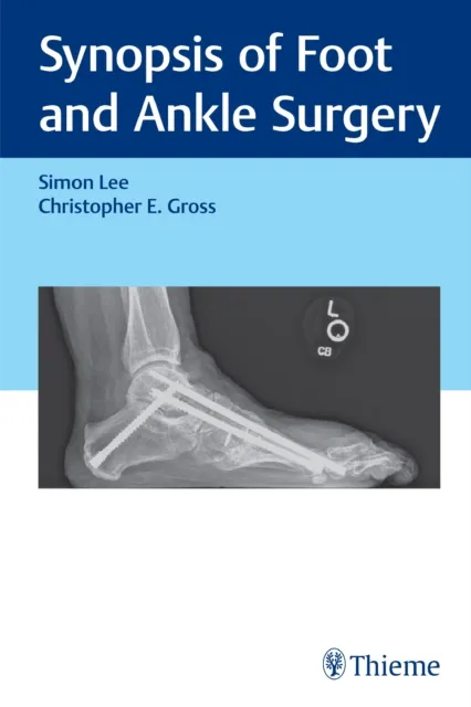 Synopsis of Foot and Ankle Surgery