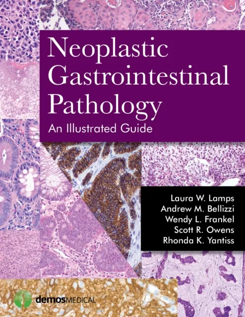 Neoplastic Gastrointestinal Pathology: An Illustrated Guide