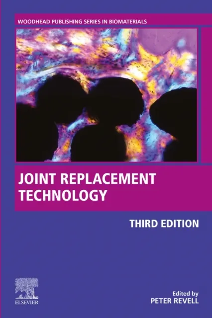 Joint Replacement Technology