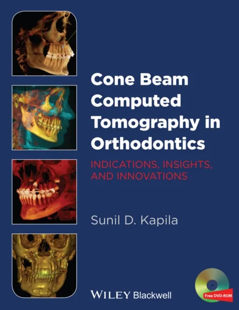 Cone Beam Computed Tomography in Orthodontics