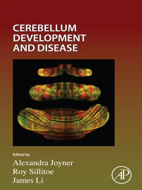 Cerebellum Development and Disease