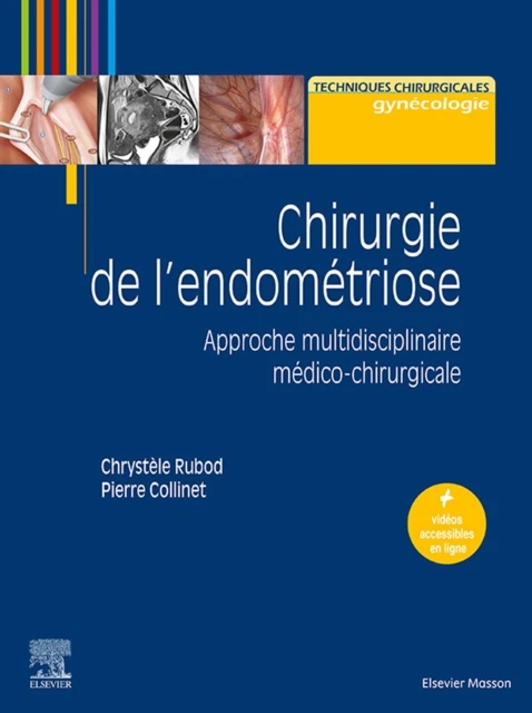 Chirurgie de l'endometriose