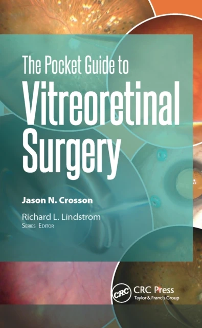 Pocket Guide to Vitreoretinal Surgery