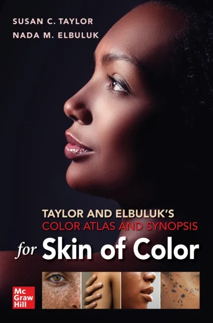 Taylor and Elbuluk's Color Atlas and Synopsis for Skin of Color