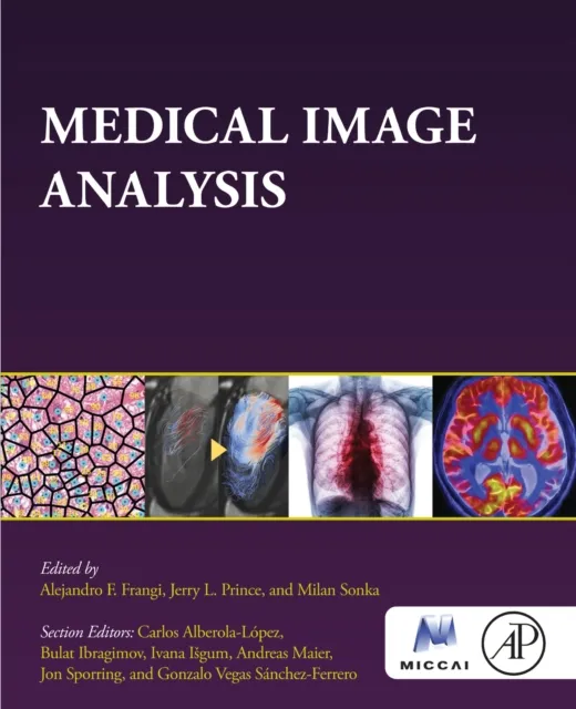 Medical Image Analysis