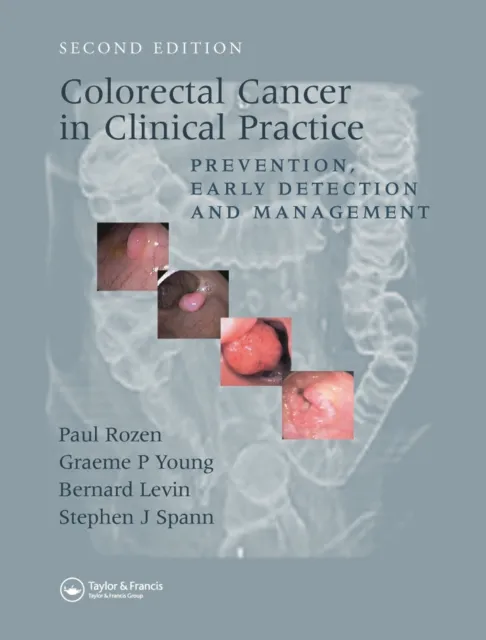 Colorectal Cancer in Clinical Practice