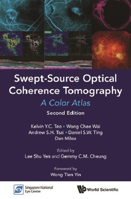Swept-source Optical Coherence Tomography: A Color Atlas (Second Edition)
