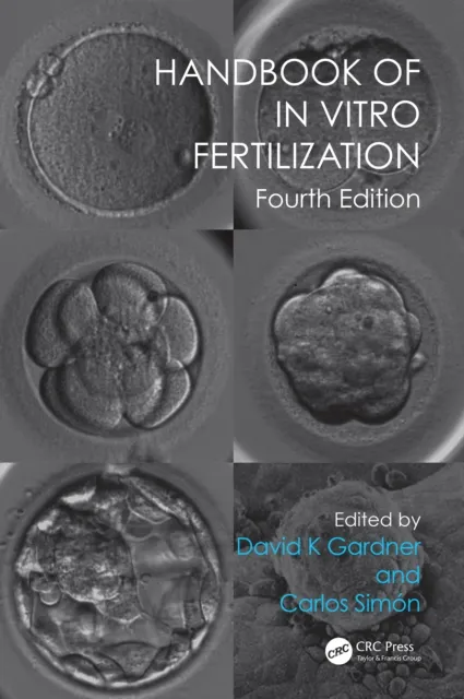 Handbook of In Vitro Fertilization