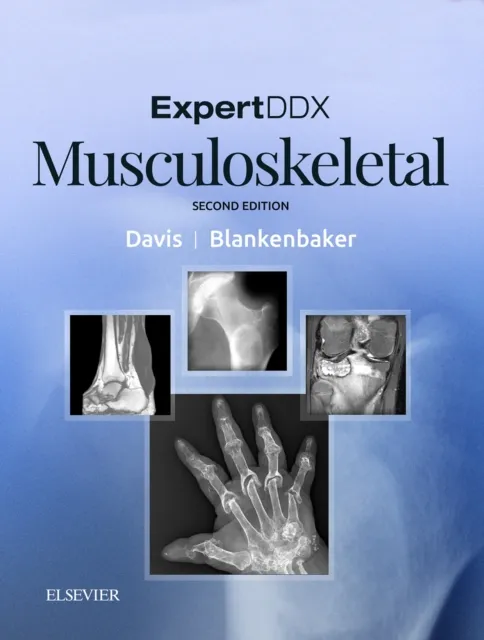 ExpertDDx: Musculoskeletal E-Book