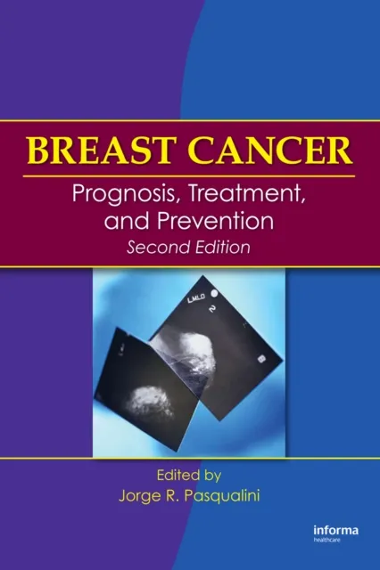 Breast Cancer