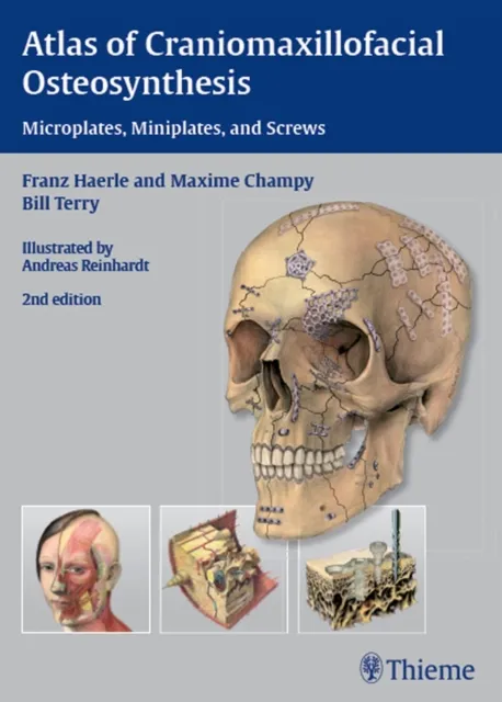 Atlas of Craniomaxillofacial Osteosynthesis