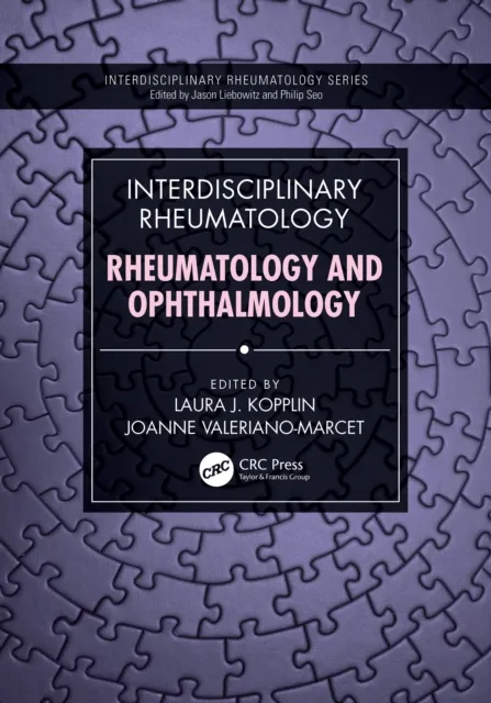 Interdisciplinary Rheumatology: Rheumatology and Ophthalmology