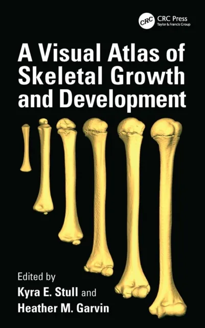 Visual Atlas of Skeletal Growth and Development